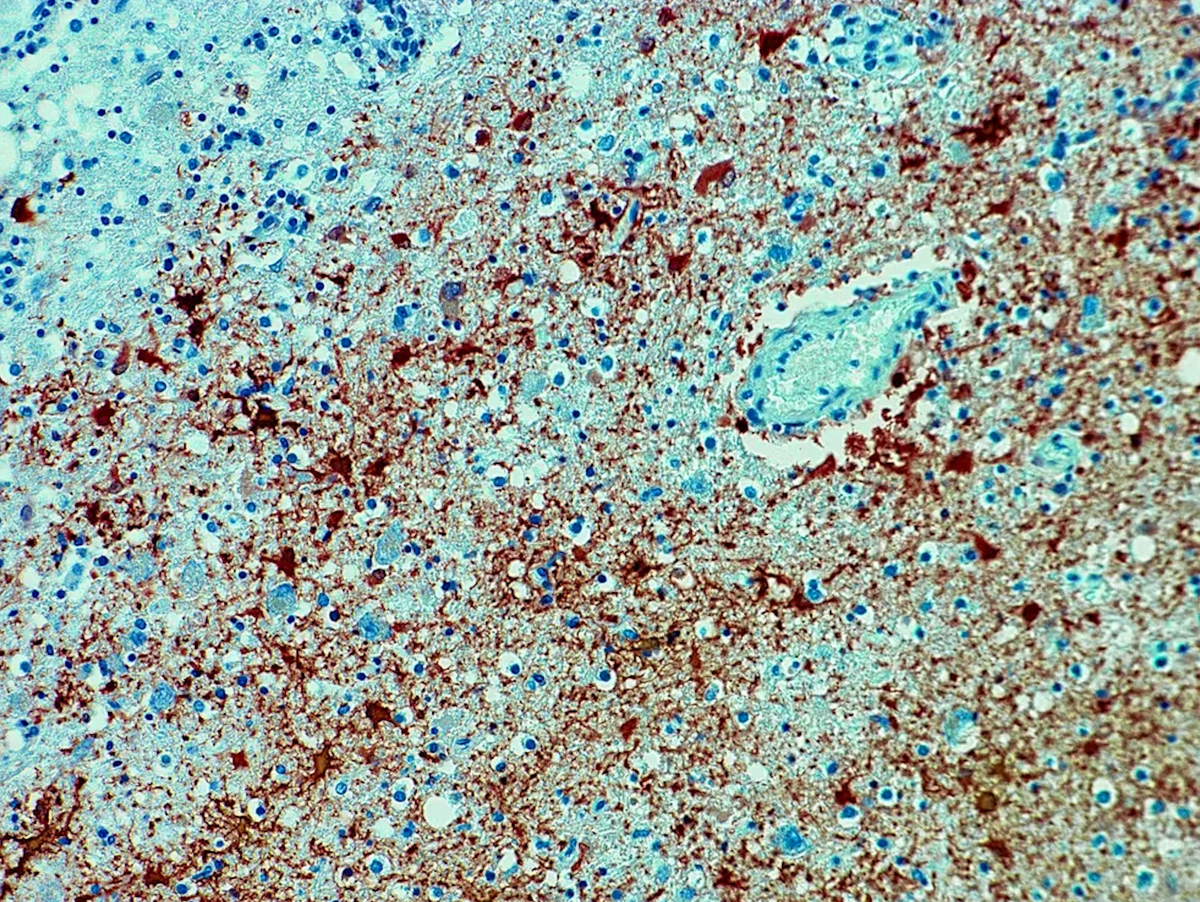 Une menace mortelle déchaînée : le virus de la Borna peut dévaster l’Europe !