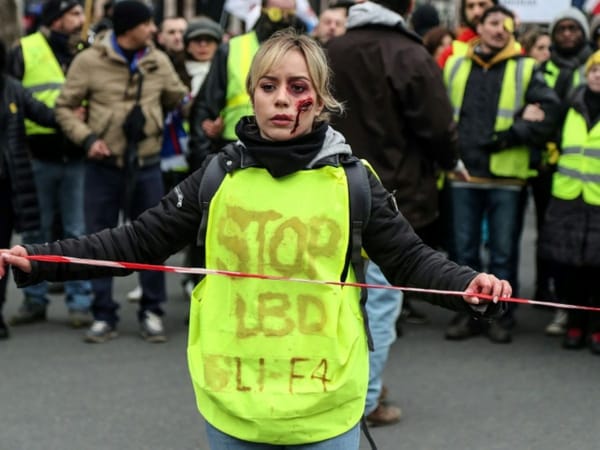 J'ai vu des gens mutilés, éborgnés, violentés. Parce qu'ils manifestaient