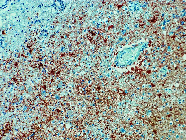 Une menace mortelle déchaînée : le virus de la Borna peut dévaster l’Europe !