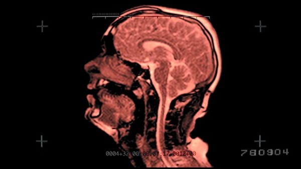 GARY BASEMAN ET DIE ANTWOORD CONTRE L’HOLOCAUSTE