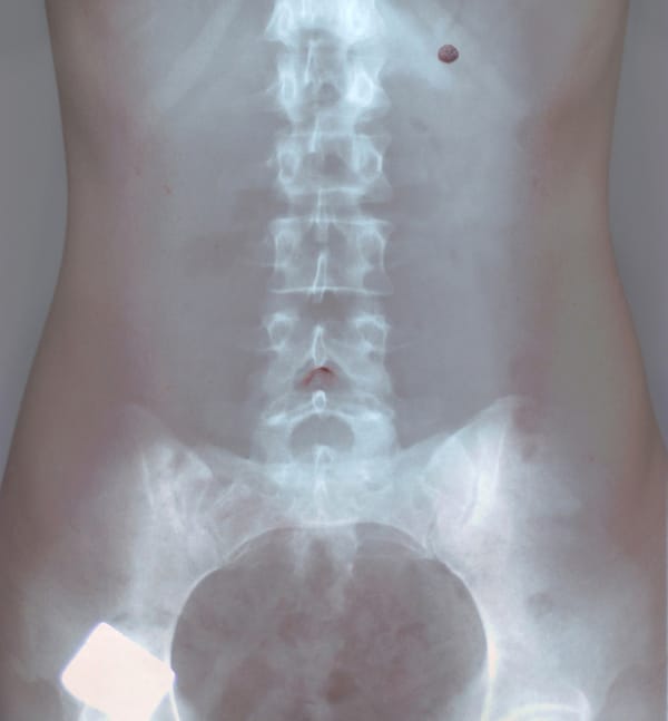 Dilek Ozturk :  Radiographie d’un corps de femme