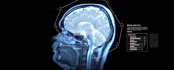 I-Art : L’intelligence artistique comme combat