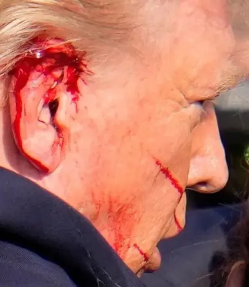 Tentative d’assassinat contre Trump : que pensez-vous de cette analyse de Scott Bennett ?