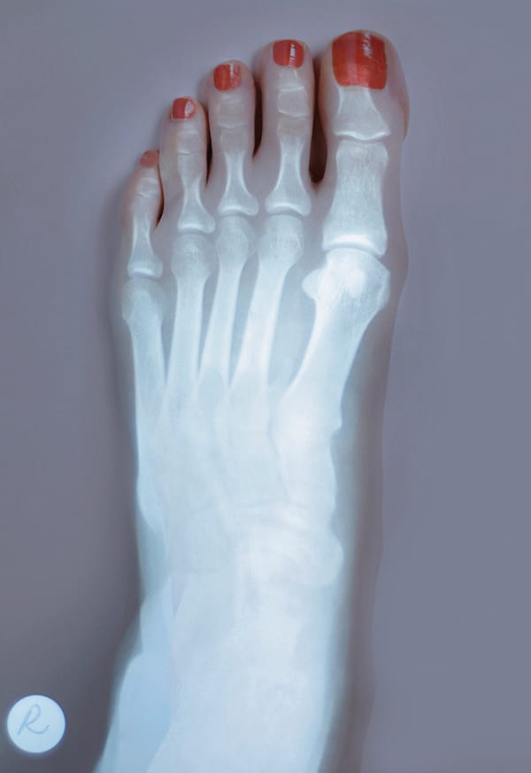 50440f56dd5344bdf51d2f4c53add744