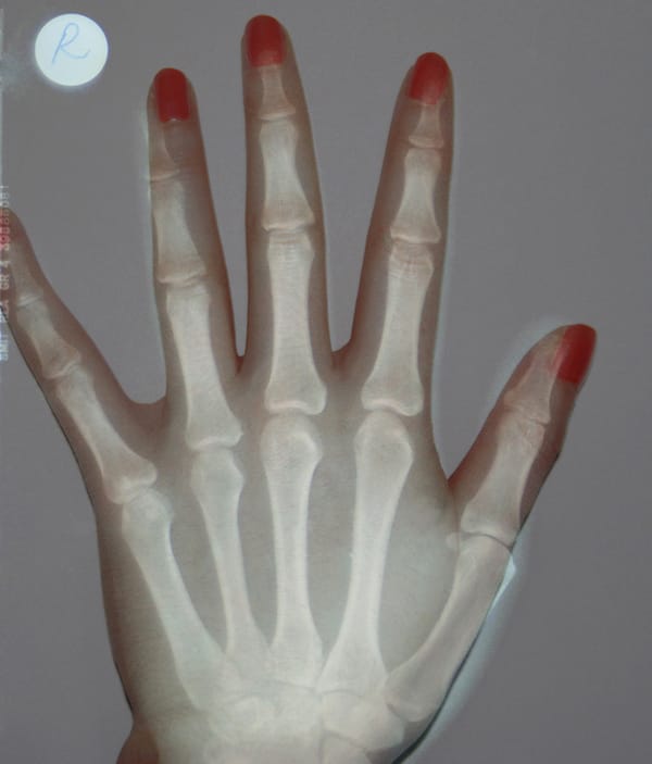 92148a1c3f008f6ca8d8d9906ac6eab5