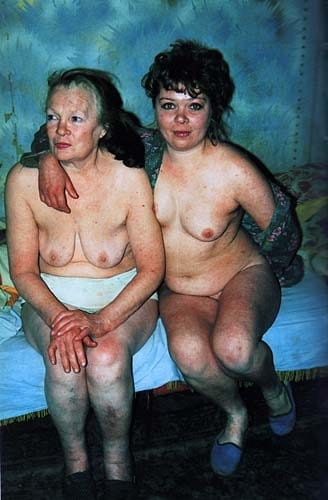 bm-case-history-p300