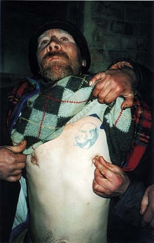 bm-case-history-p308