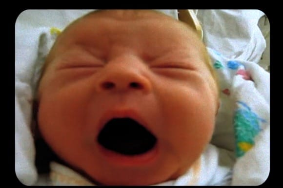 Everynone-Yaws-580x386