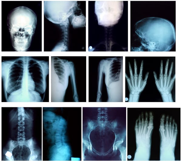 fc24d98981519aa00db5e1e87d50df9c