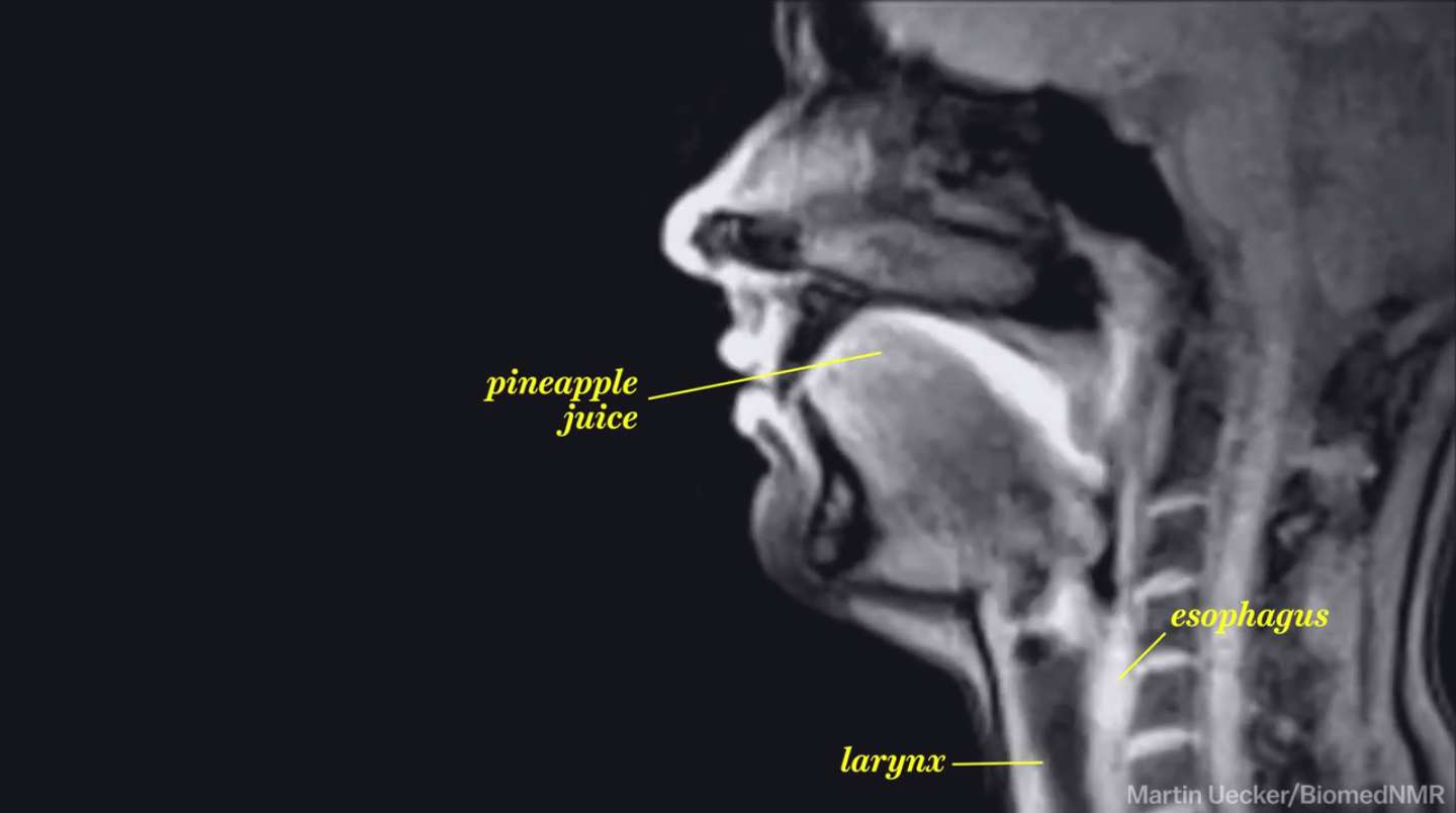 IMAGE d'ecran 2014-09-22 13.27.56