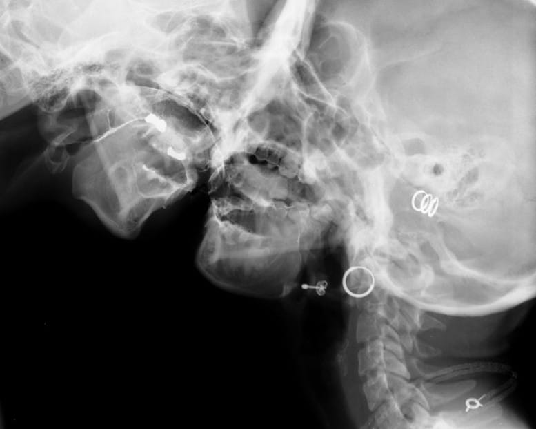 Wim_Delvoye_sexrays_3-777x621