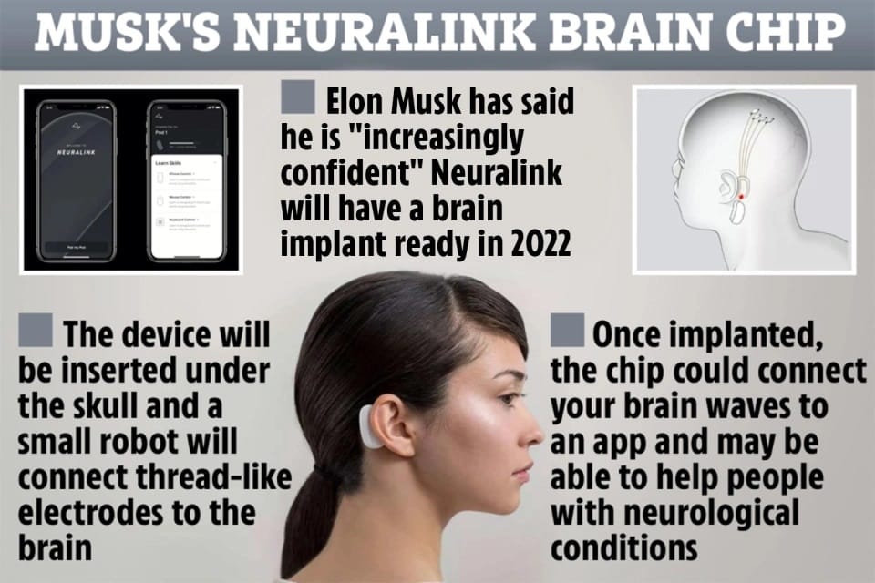Neuralink implants Elon Musk