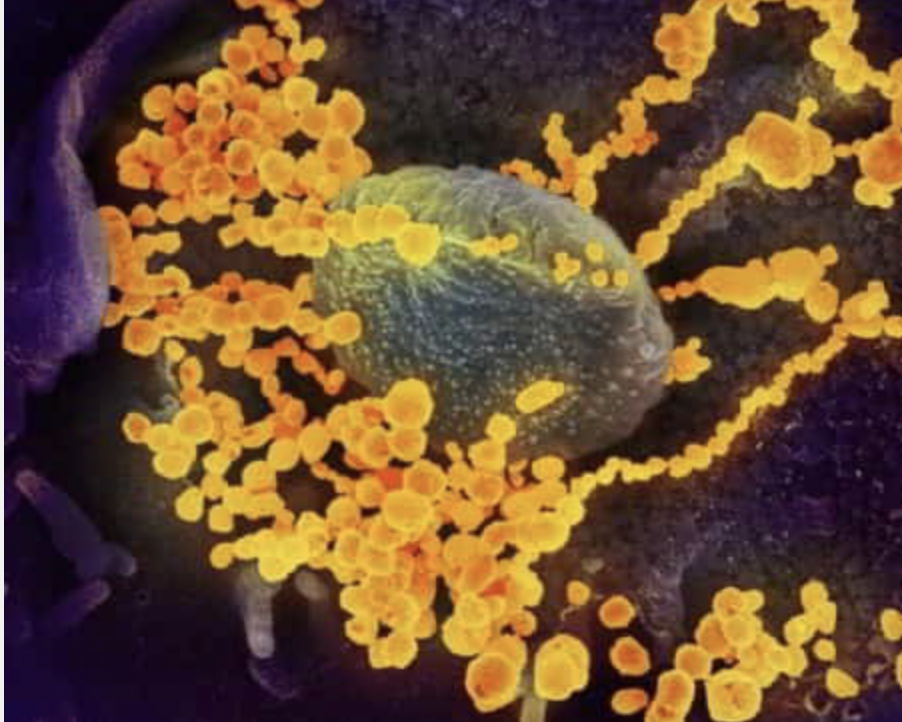 Une image au microscope électronique montre le SARS-CoV-2 (objets ronds et dorés), qui cause le COVID-19, émergeant de cellules en culture. (NIAID)